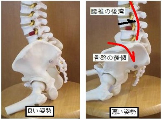 八戸整体 坐骨神経痛