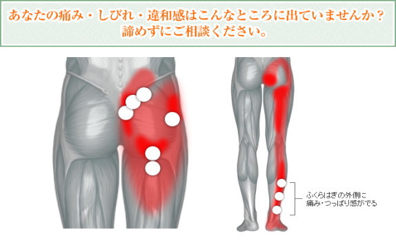 坐骨神経痛の整体 八戸