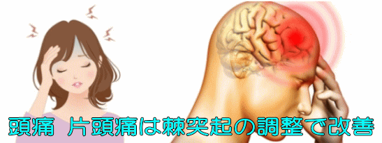頭痛 片頭痛の整体